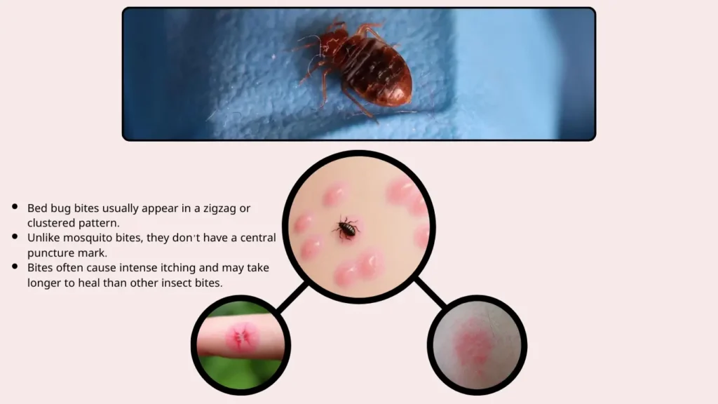 How to Differentiate from Other Insect Bites