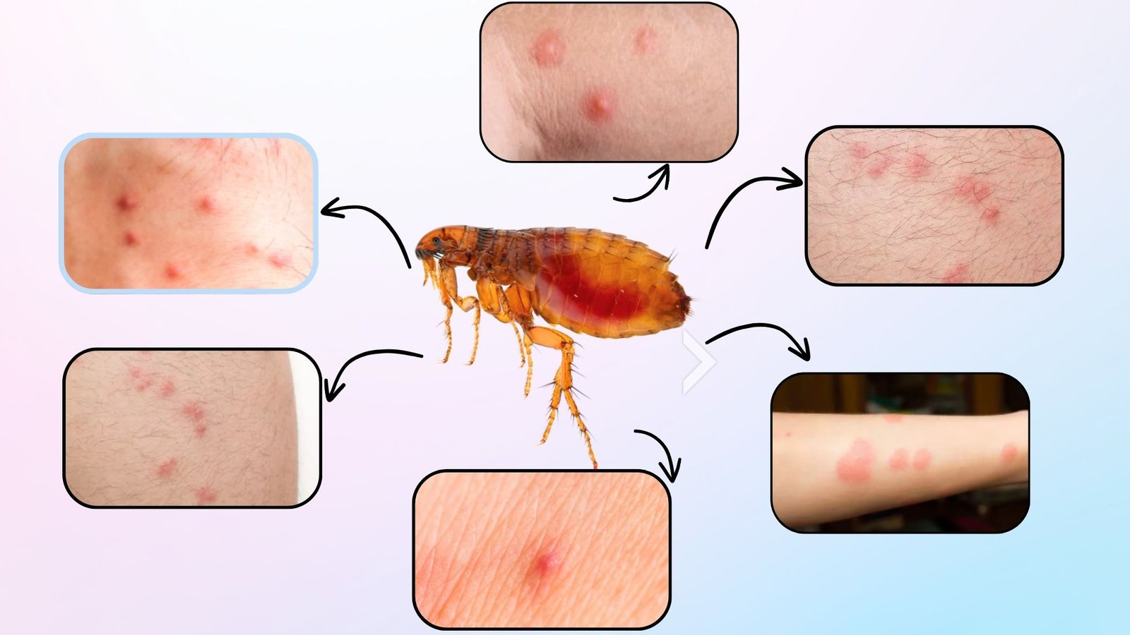 What Do Flea Bites Look Like On Humans Id With Images All For One