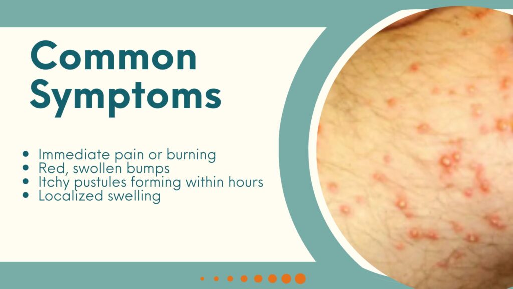 Symptoms & Reactions to Fire Ant Bites