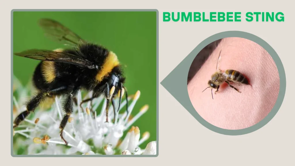 Bumblebee Sting