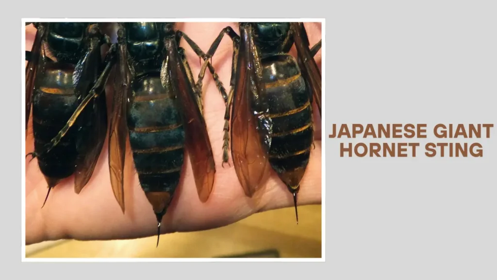 Japanese Giant Hornet Sting