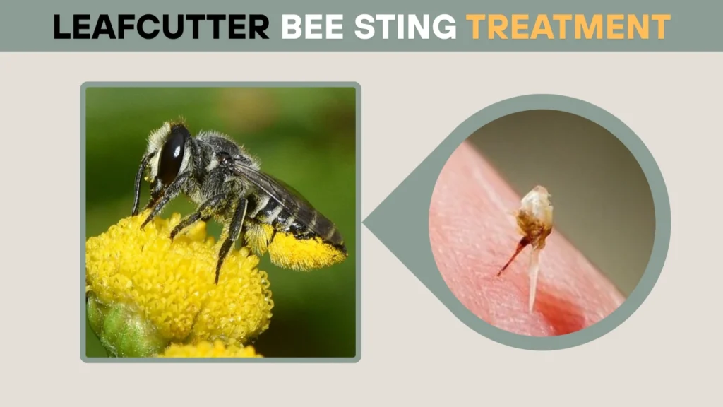 Leafcutter Bee Sting Treatment