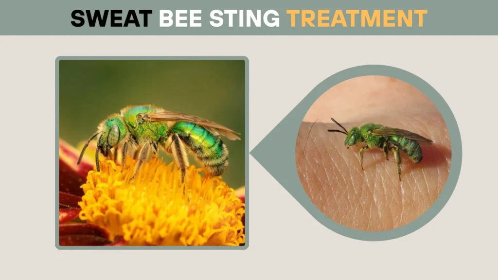 Sweat Bee Sting Treatment