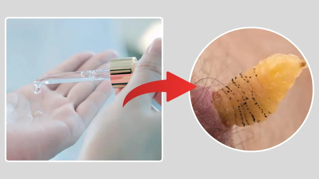 Turpentine or Camphor Oil Application