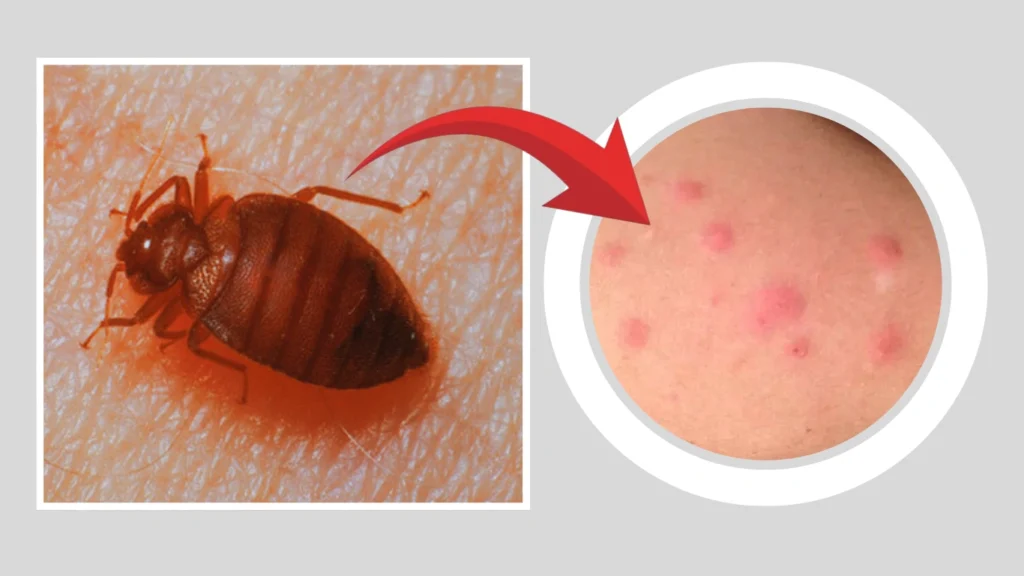 What Do Cimexopsis nyctalis Bites Look Like