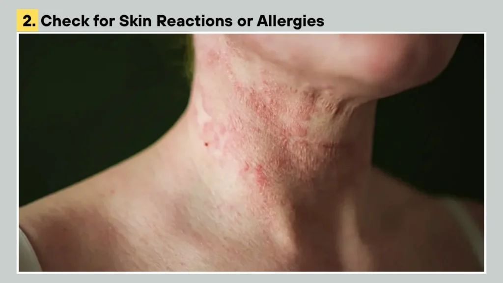 2. Check for Skin Reactions or Allergies