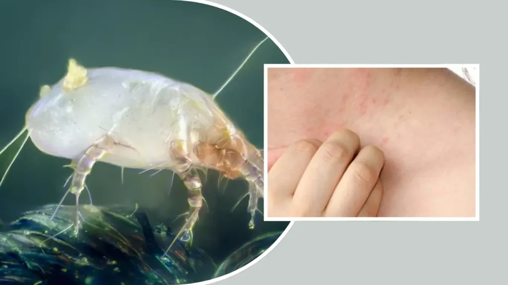 If They Don’t Bite, Why Am I Itching