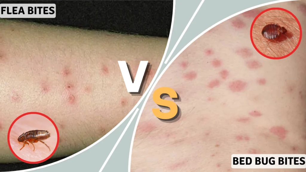 Flea Bites vs. Bed Bug Bites