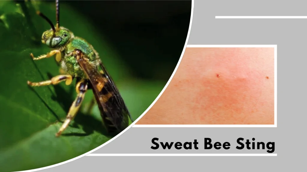 Sweat Bee Sting