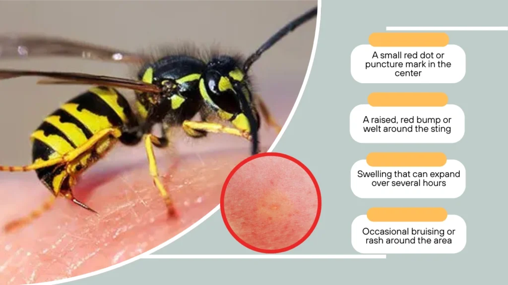 What Does a Yellow Jacket Sting Look and Feel Like