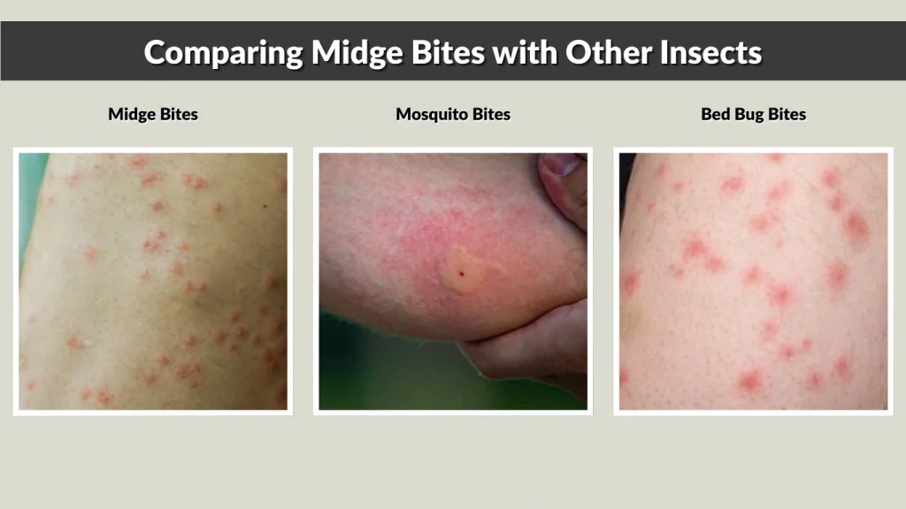 Midge Bites Symptoms Reaction Treatment Prevention