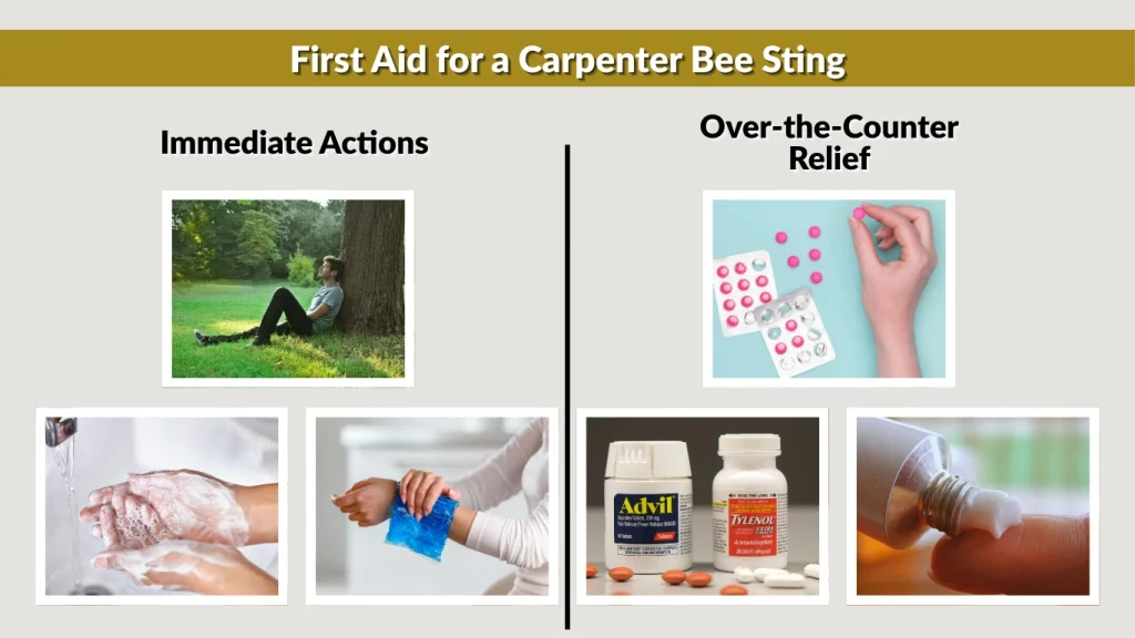 First Aid for a Carpenter Bee Sting