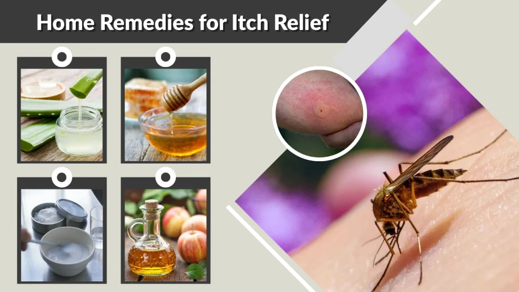 Home Remedies for Itch Relief