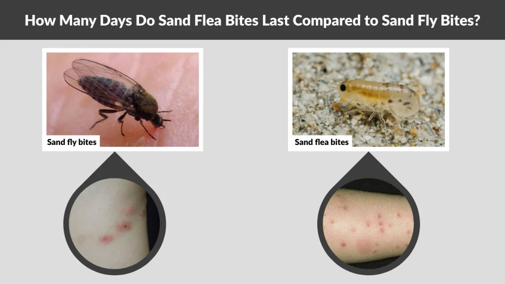 How Many Days Do Sand Flea Bites Last Compared to Sand Fly Bites