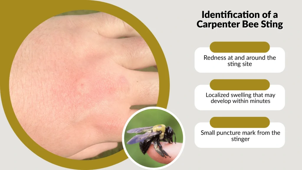 Identification of a Carpenter Bee Sting