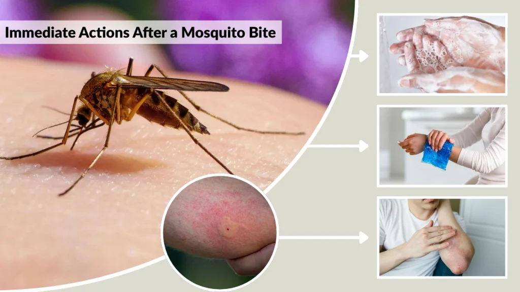 Immediate Actions After a Mosquito Bite