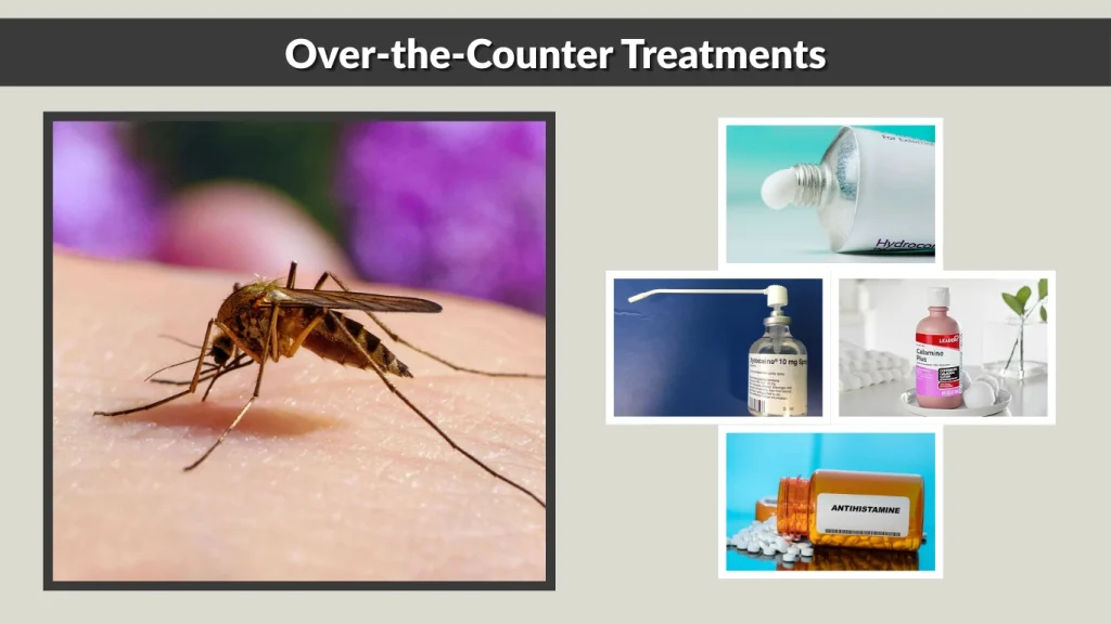 Over-the-Counter Treatments