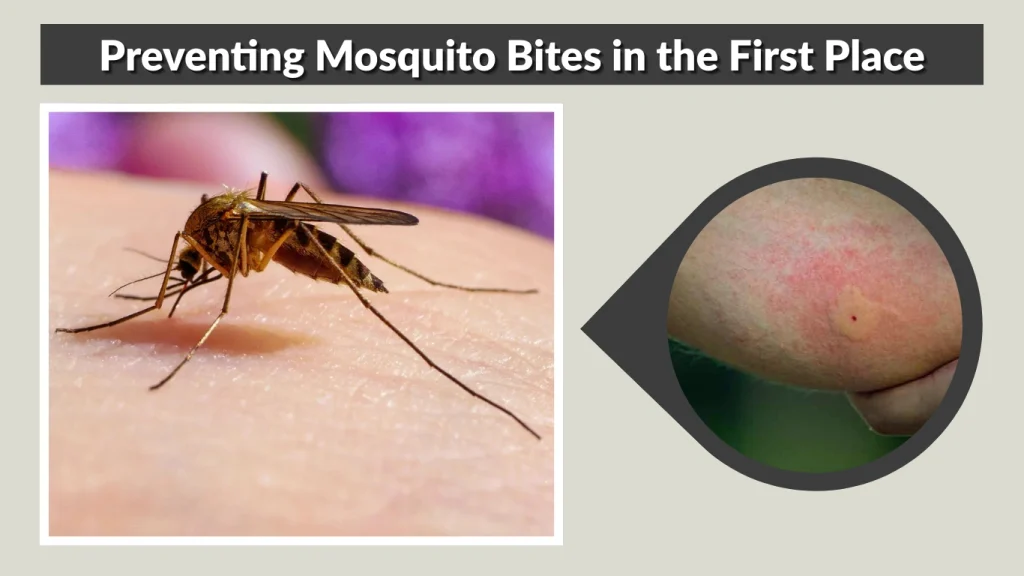 Preventing Mosquito Bites in the First Place