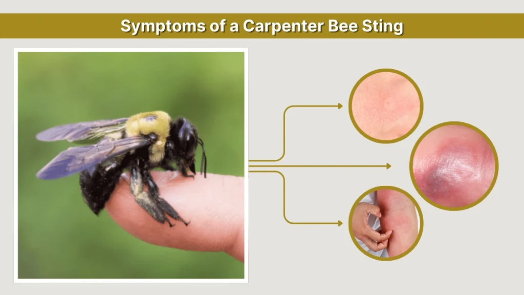 Symptoms of a Carpenter Bee Sting