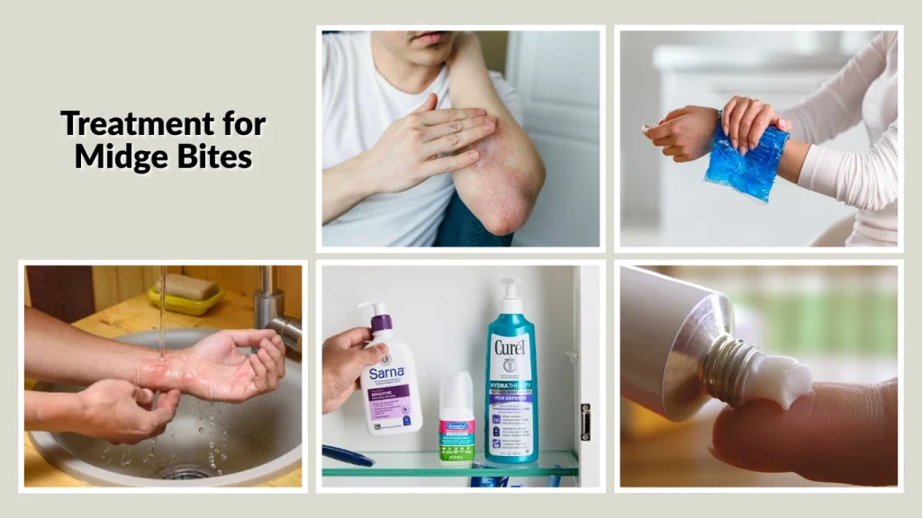 Midge Bites Symptoms Reaction Treatment Prevention