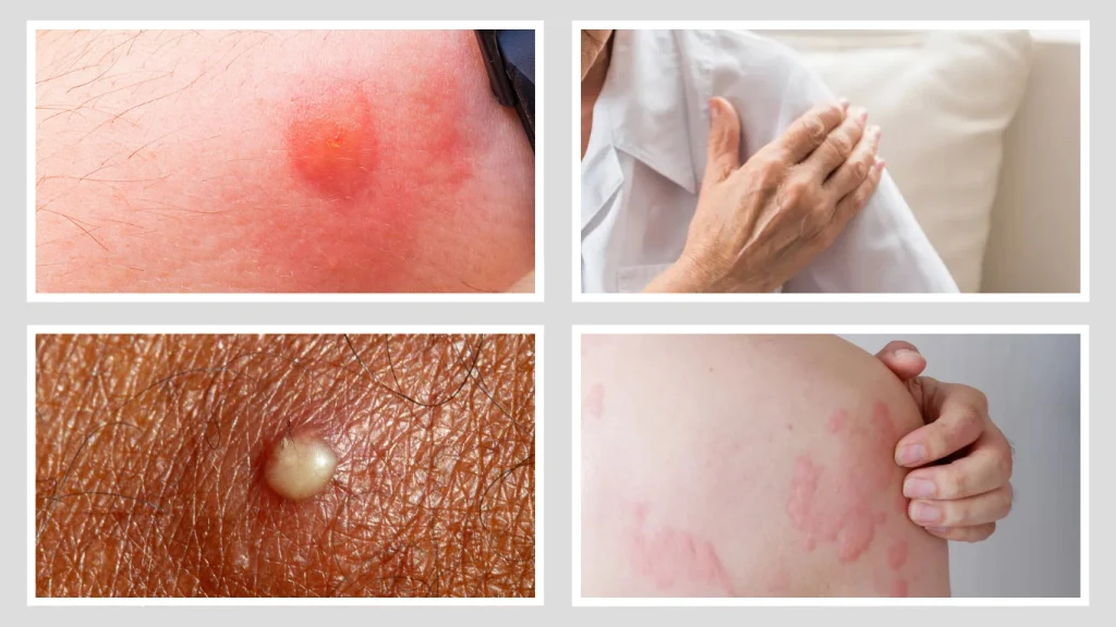 When to See a Doctor