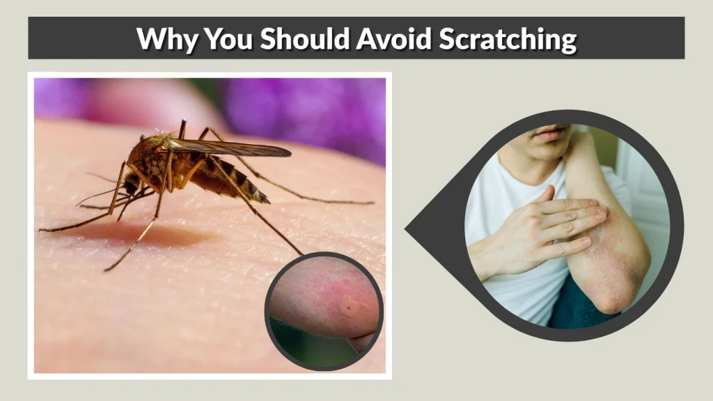 Why You Should Avoid Scratching
