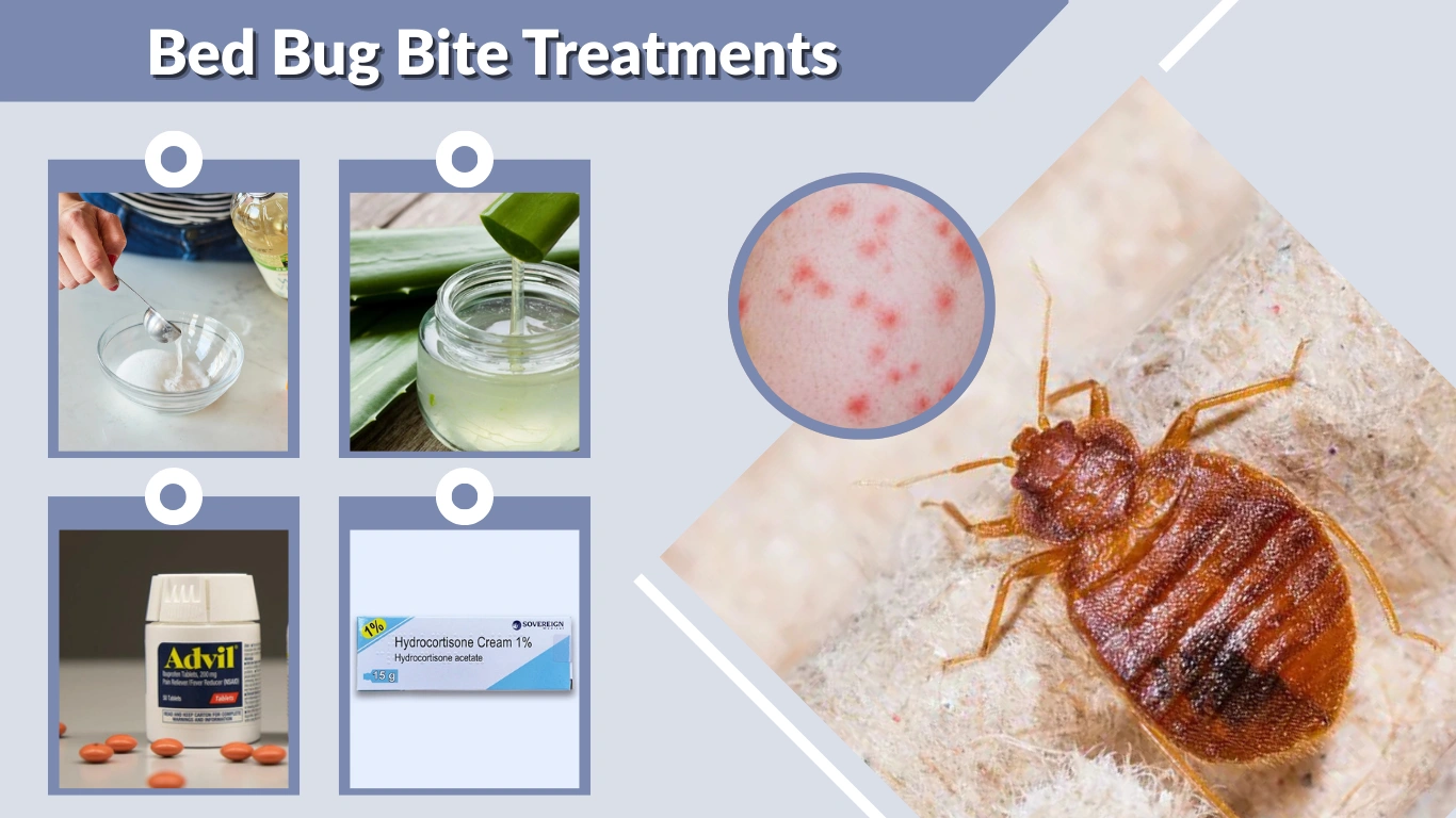 Bed Bug Bite Treatments Complete Guide To Relief Recovery And Prevention Bed Bug Bite Treatments Complete Guide To Relief Recovery And Prevention