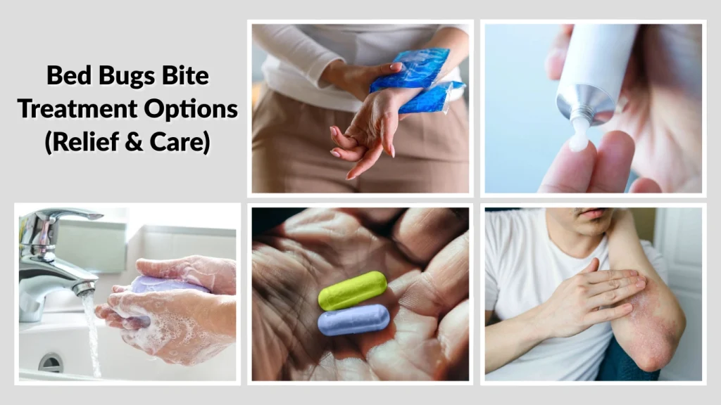 Bed Bugs Bite Treatment Options (Relief & Care)