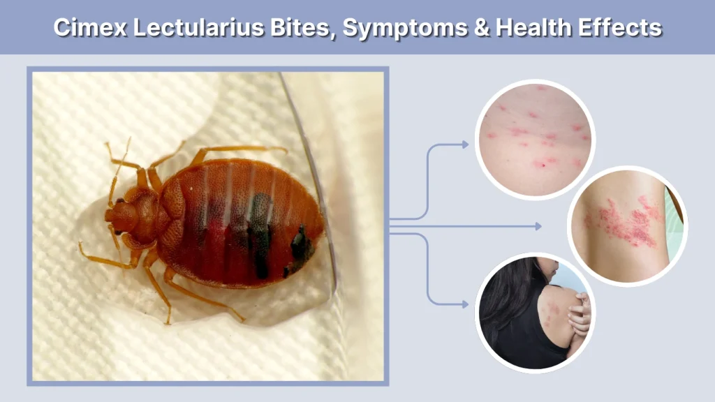 Cimex Lectularius Bites, Symptoms & Health Effects