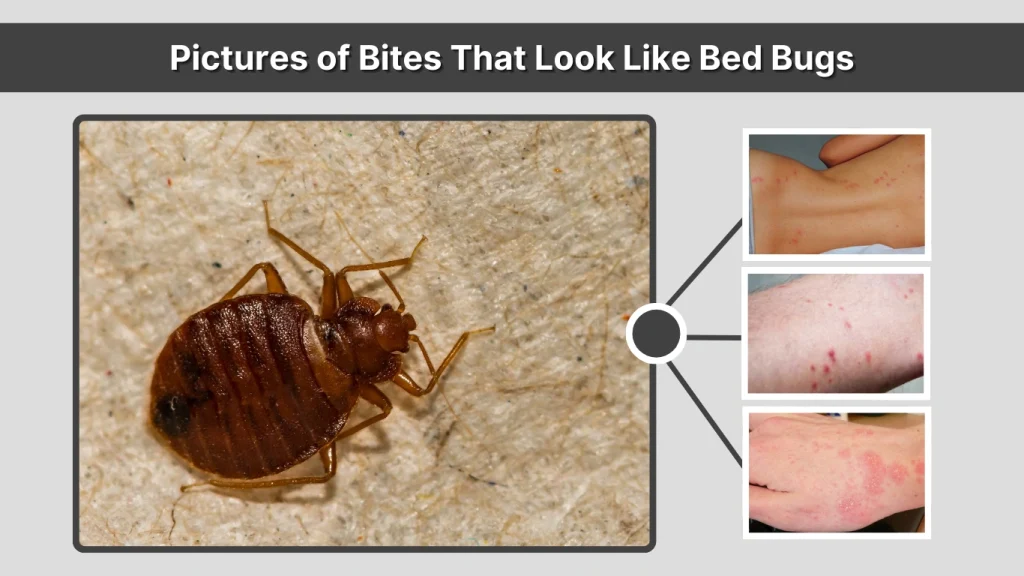 Pictures of Bites That Look Like Bed Bugs