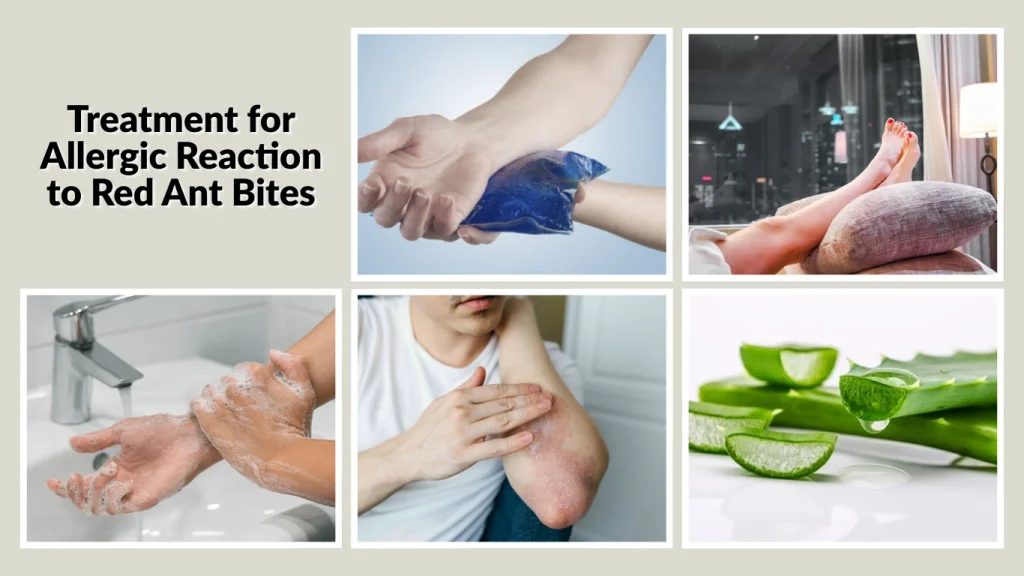 Treatment for Allergic Reaction to Red Ant Bites