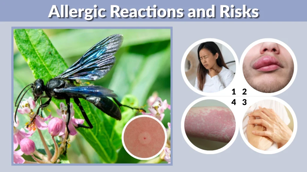 Allergic Reactions and Risks