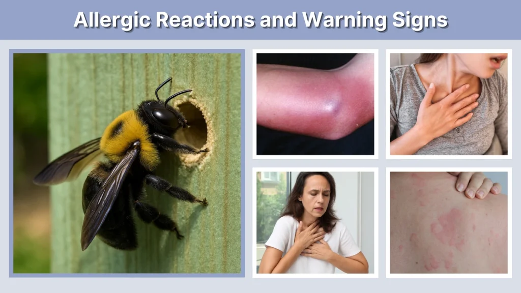 Allergic Reactions and Warning Signs