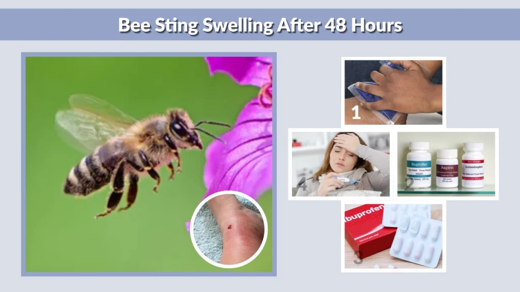 Bee Sting Swelling After 48 Hours