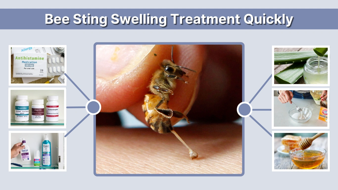 Bee Sting Swelling Treatment Quickly (With Natural Remedies)