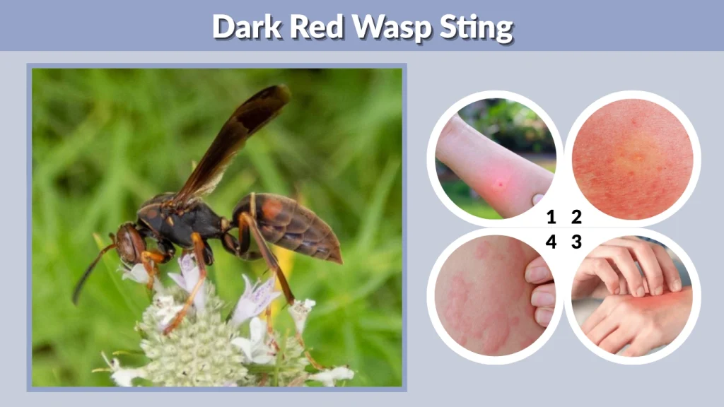 Dark Red Wasp Sting