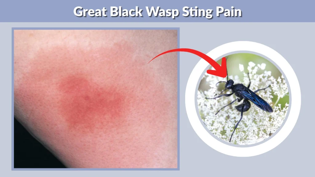Great Black Wasp Sting Pain