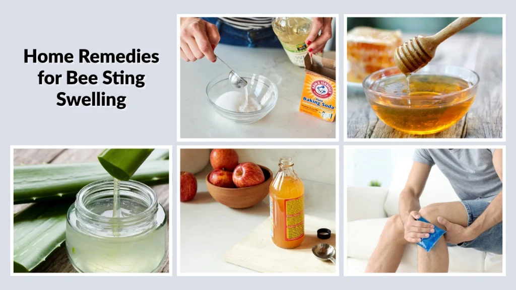 Home Remedies for Bee Sting Swelling