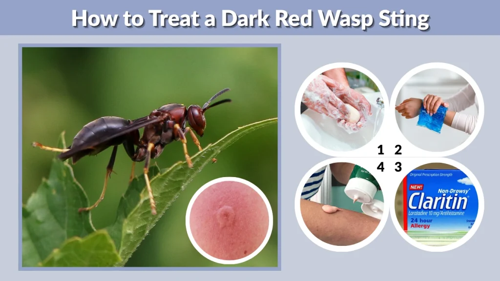 How to Treat a Dark Red Wasp Sting