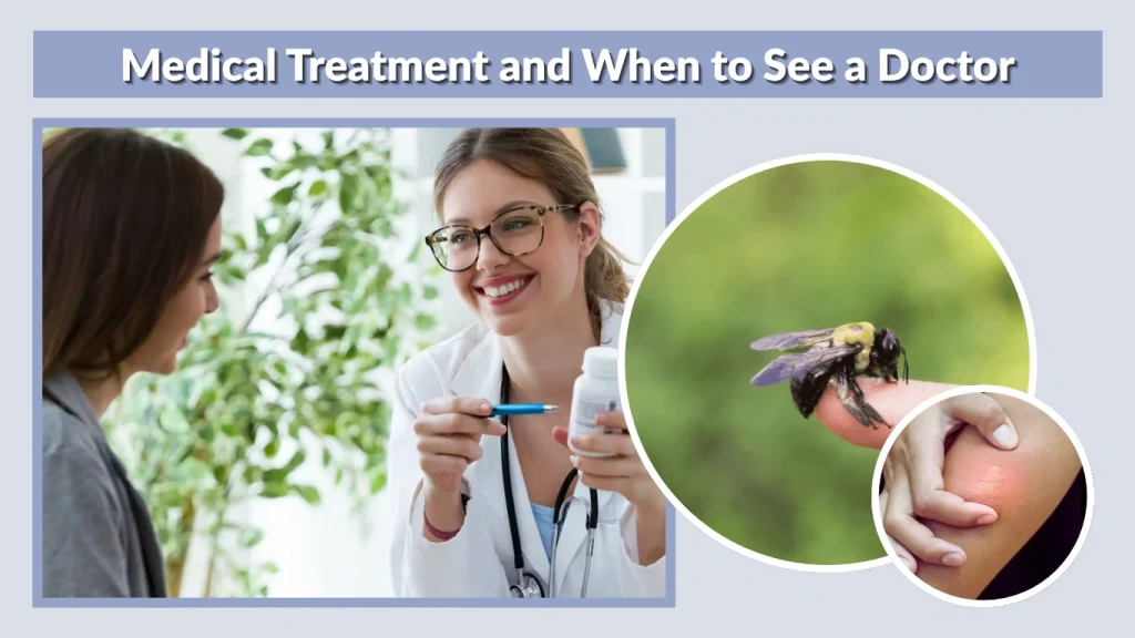 Medical Treatment and When to See a Doctor