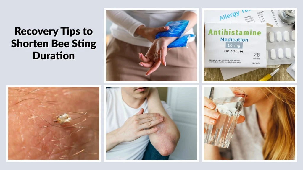 Recovery Tips to Shorten Bee Sting Duration