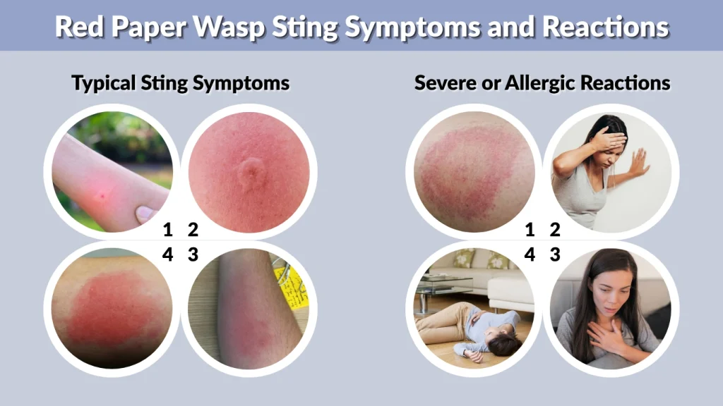 Red Paper Wasp Sting Symptoms and Reactions