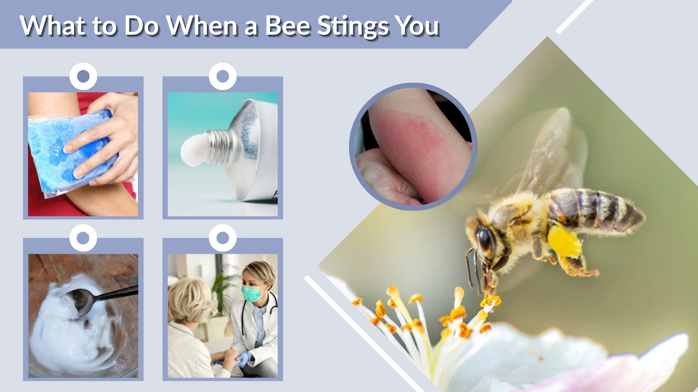 What to Do When a Bee Stings You Immediate Treatment and Care