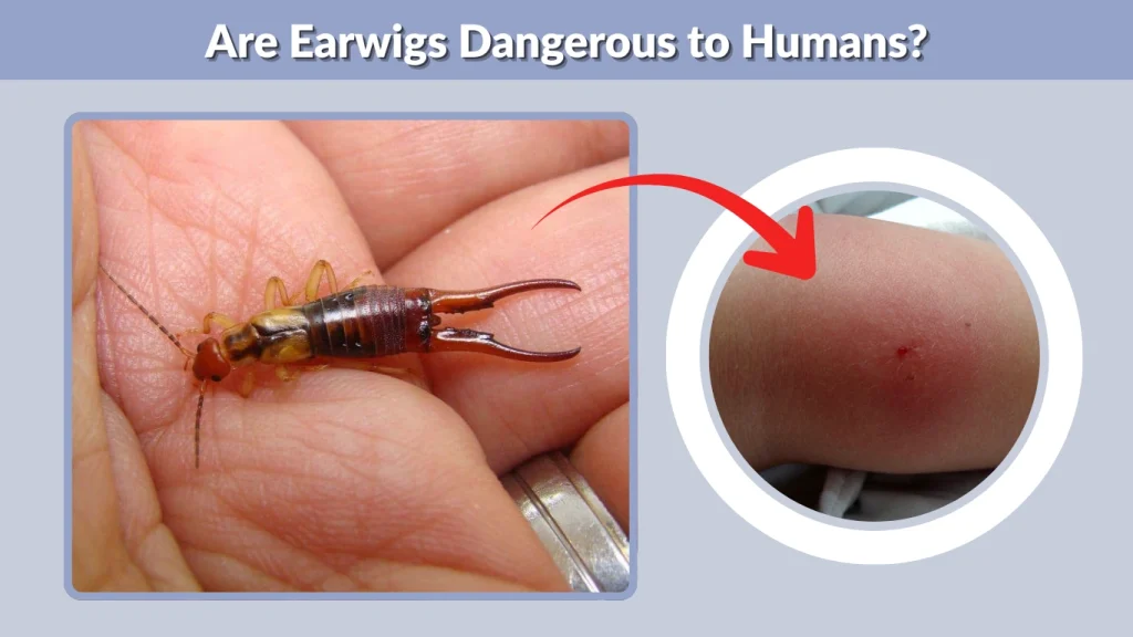 Are Earwigs Dangerous to Humans
