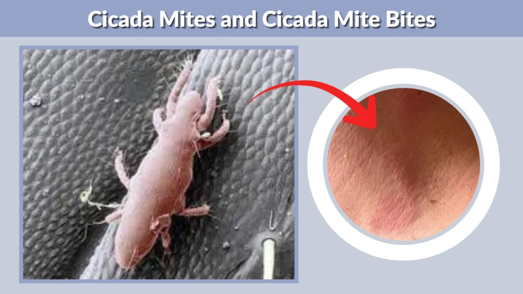 Cicada Mites and Cicada Mite Bites