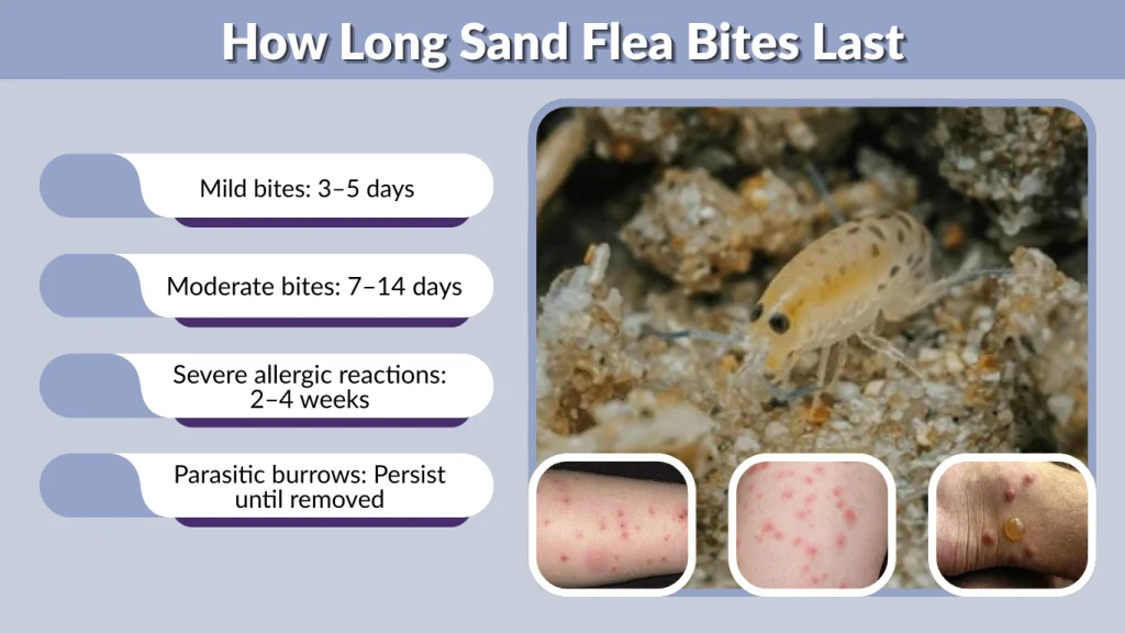 How Long Sand Flea Bites Last