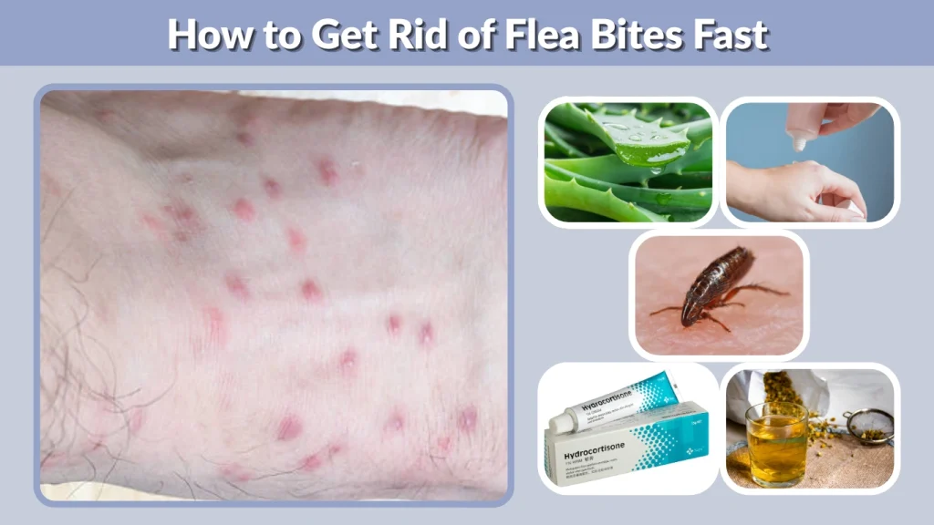 How to Get Rid of Flea Bites Fast