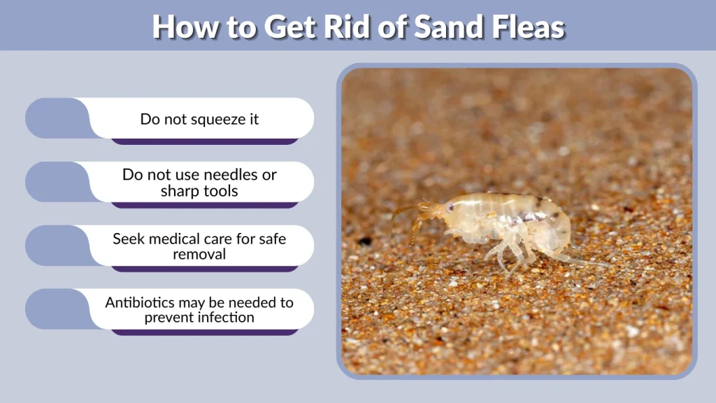 How to Get Rid of Sand Fleas