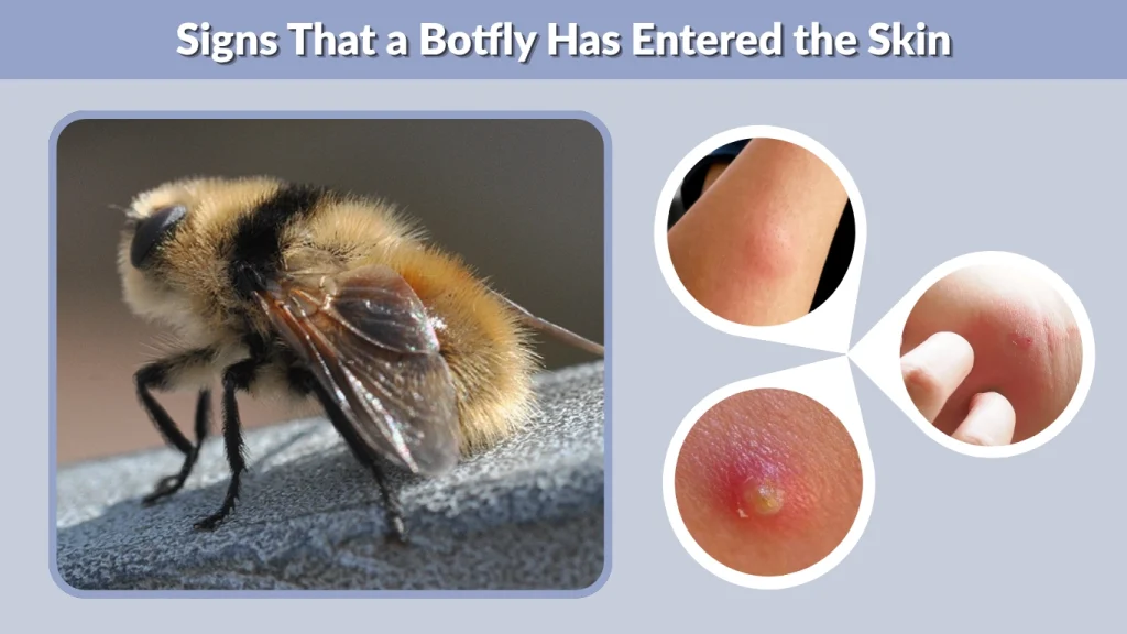 Signs That a Botfly Has Entered the Skin
