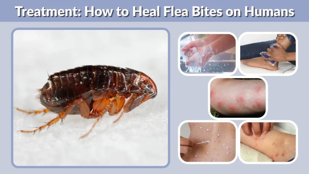 Treatment How to Heal Flea Bites on Humans